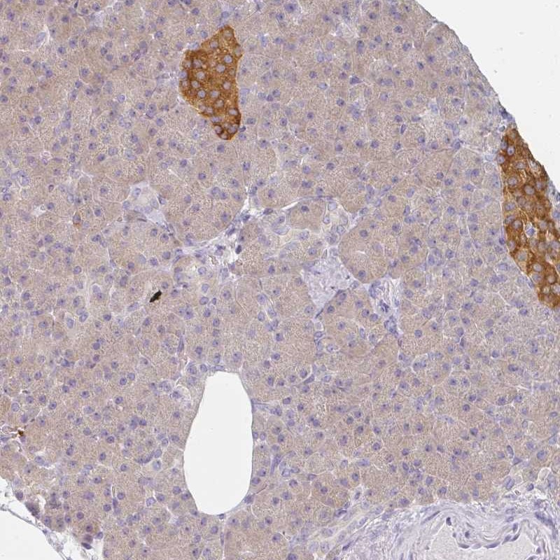 Anti-AMPD2 Antibody