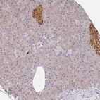Anti-AMPD2 Antibody