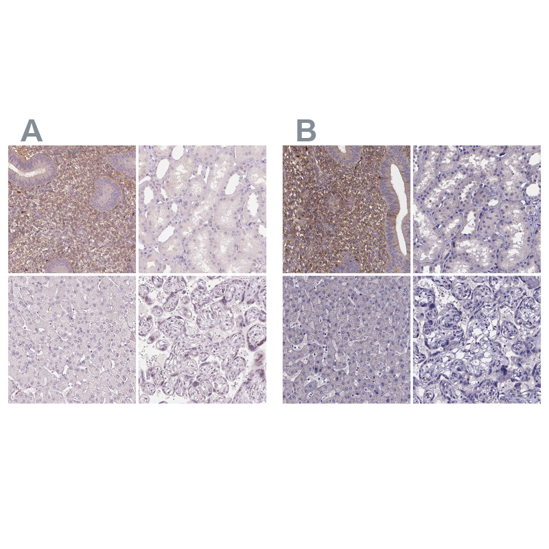 Anti-SFRP4 Antibody