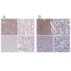 Anti-SFRP4 Antibody