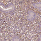 Immunohistochemical staining of human endometrium shows moderate secreted positivity in cells in endometrial stroma.