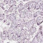Immunohistochemical staining of human placenta shows no positivity in trophoblastic cells as expected.