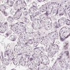 Immunohistochemical staining of human placenta shows no positivity in trophoblastic cells as expected.
