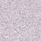 Immunohistochemical staining of human liver shows no positivity in hepatocytes as expected.