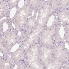 Immunohistochemical staining of human kidney shows no positivity in cells in tubules as expected.