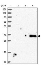 Lane 1: Marker [kDa] 250, 130, 95, 72, 55, 36, 28, 17, 10_br/_Lane 2: Human cell line RT-4_br/_Lane 3: Human cell line U-251 MG_br/_Lane 4: Human plasma