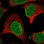 Anti-MTBP Antibody