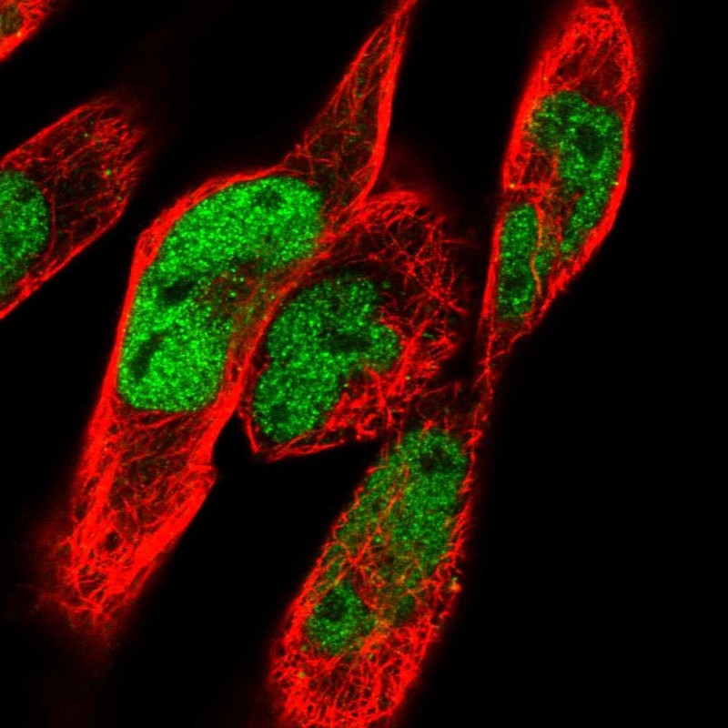 Anti-CACUL1 Antibody