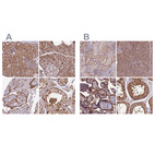 Anti-NSFL1C Antibody