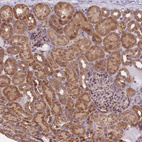 Immunohistochemical staining of human kidney shows strong cytoplasmic positivity in cells in tubules.