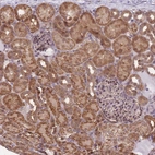 Immunohistochemical staining of human kidney shows strong cytoplasmic positivity in cells in tubules.