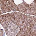 Immunohistochemical staining of human pancreas shows strong nuclear and cytoplasmic positivity in exocrine glandular cells.