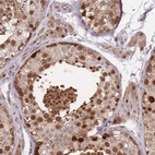 Immunohistochemical staining of human testis shows strong nuclear and cytoplasmic positivity in cells in seminiferous ducts.