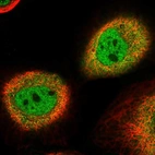 Immunofluorescent staining of human cell line A-431 shows localization to nucleoplasm & cytosol.