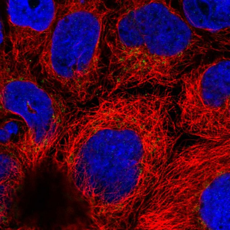 Anti-ARFRP1 Antibody