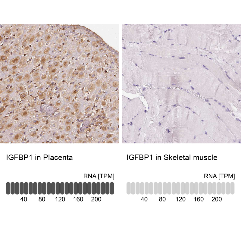 Anti-IGFBP1 Antibody