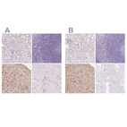 Immunohistochemical staining of human kidney, lymphoid tissues, placenta and skeletal muscle using Anti-IGFBP1 antibody HPA050640 (A) shows similar protein distribution across tissues to independent antibody HPA046972 (B).