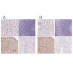 Immunohistochemical staining of human kidney, lymphoid tissues, placenta and skeletal muscle using Anti-IGFBP1 antibody HPA050640 (A) shows similar protein distribution across tissues to independent antibody HPA046972 (B).