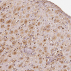 Immunohistochemical staining of human placenta shows moderate cytoplasmic positivity in decidual cells.