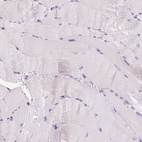 Immunohistochemical staining of human skeletal muscle shows no positivity in myocytes as expected.