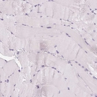 Immunohistochemical staining of human skeletal muscle shows no positivity in myocytes as expected.