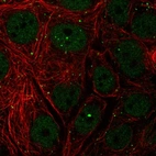 Immunofluorescent staining of human cell line MCF7 shows localization to nucleoplasm, nuclear bodies & vesicles.