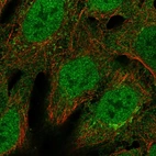 Immunofluorescent staining of human cell line RT4 shows localization to nucleoplasm & the Golgi apparatus.