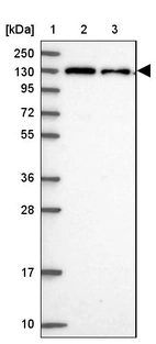 Lane 1: Marker [kDa] 250, 130, 95, 72, 55, 36, 28, 17, 10_br/_Lane 2: Human cell line RT-4_br/_Lane 3: Human cell line U-251MG sp