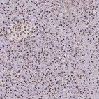 Anti-BBX Antibody