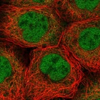 Immunofluorescent staining of human cell line A-431 shows localization to nucleoplasm & cytosol.