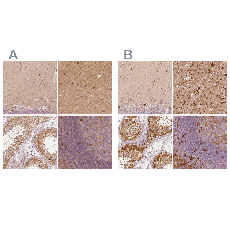 Anti-FSCN1 Antibody