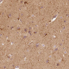 Immunohistochemical staining of human cerebral cortex shows strong cytoplasmic positivity in glial cells.