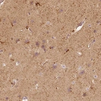 Immunohistochemical staining of human cerebral cortex shows strong cytoplasmic positivity in glial cells.