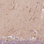 Immunohistochemical staining of human cerebellum shows strong cytoplasmic positivity in cells in molecular layer.