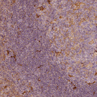 Immunohistochemical staining of human tonsil shows strong cytoplasmic positivity in non-germinal center cells.