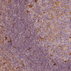 Anti-FSCN1 Antibody