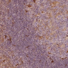 Immunohistochemical staining of human tonsil shows strong cytoplasmic positivity in non-germinal center cells.