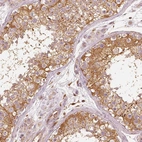 Immunohistochemical staining of human testis shows strong cytoplasmic positivity in cells in seminiferous ducts.