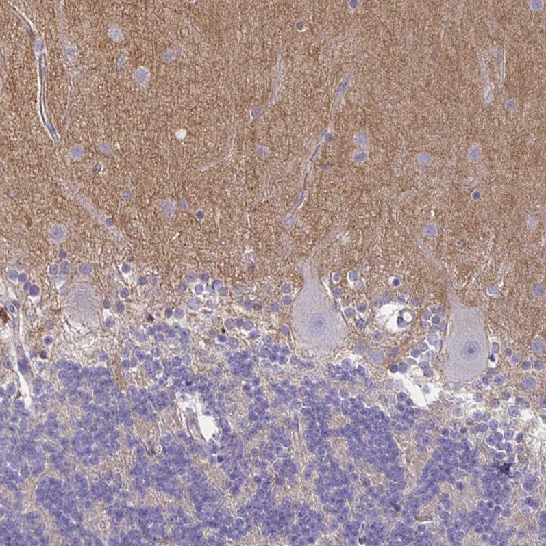 Anti-TTYH1 Antibody