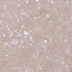 Immunohistochemical staining of human cerebral cortex shows weak positivity in neuropil.