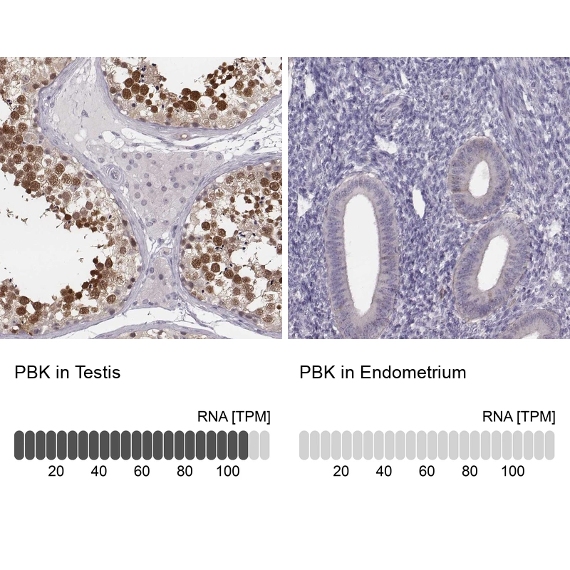 Rabbit Polyclonal Anti-PBK Antibody - Buy for research - Highly ...