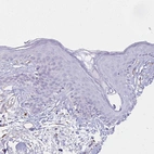 Immunohistochemical staining of human skin shows no positivity in squamous epithelial cells as expected.