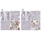 Immunohistochemical staining of human colon, kidney, liver and testis using Anti-PBK antibody HPA050656 (A) shows similar protein distribution across tissues to independent antibody HPA005753 (B).