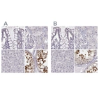 Immunohistochemical staining of human colon, kidney, liver and testis using Anti-PBK antibody HPA050656 (A) shows similar protein distribution across tissues to independent antibody HPA005753 (B).