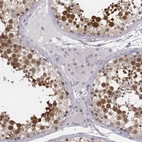 Immunohistochemical staining of human testis shows high expression.
