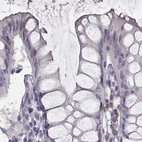 Immunohistochemical staining of human colon using Anti-PBK antibody HPA050656.