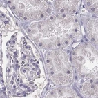 Immunohistochemical staining of human kidney using Anti-PBK antibody HPA050656.