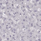 Immunohistochemical staining of human liver using Anti-PBK antibody HPA050656.