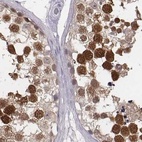 Immunohistochemical staining of human testis using Anti-PBK antibody HPA050656.
