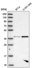 Western blot analysis in human cell line RT-4 and human cell line U-251 MG.